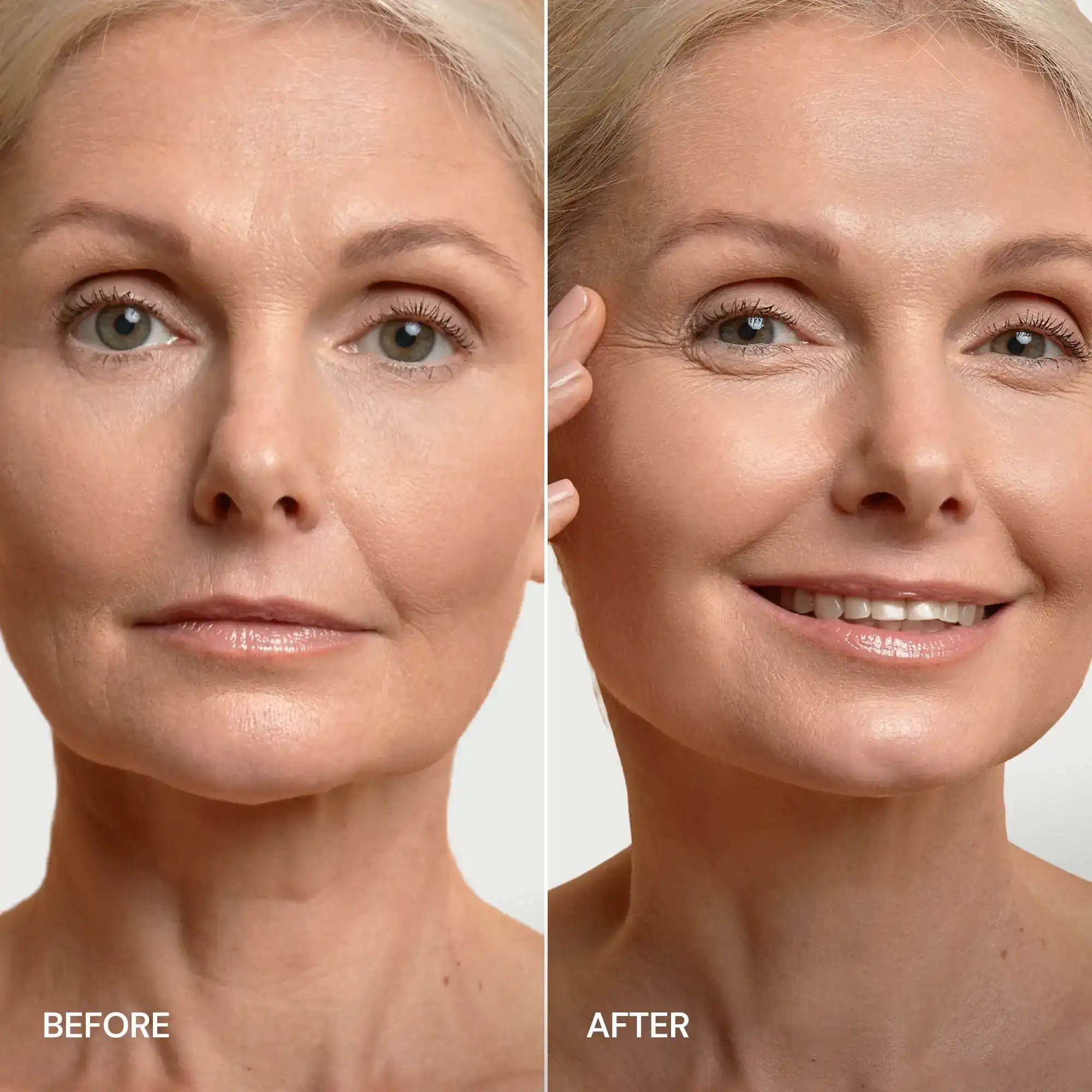 Maree 24K Gold V-Line Lifting Mask