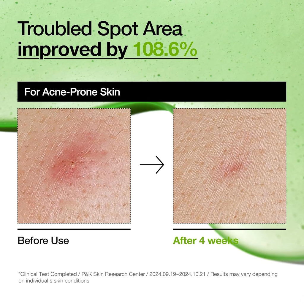 Anua Azelaic Acid 10% Serum (30ml)