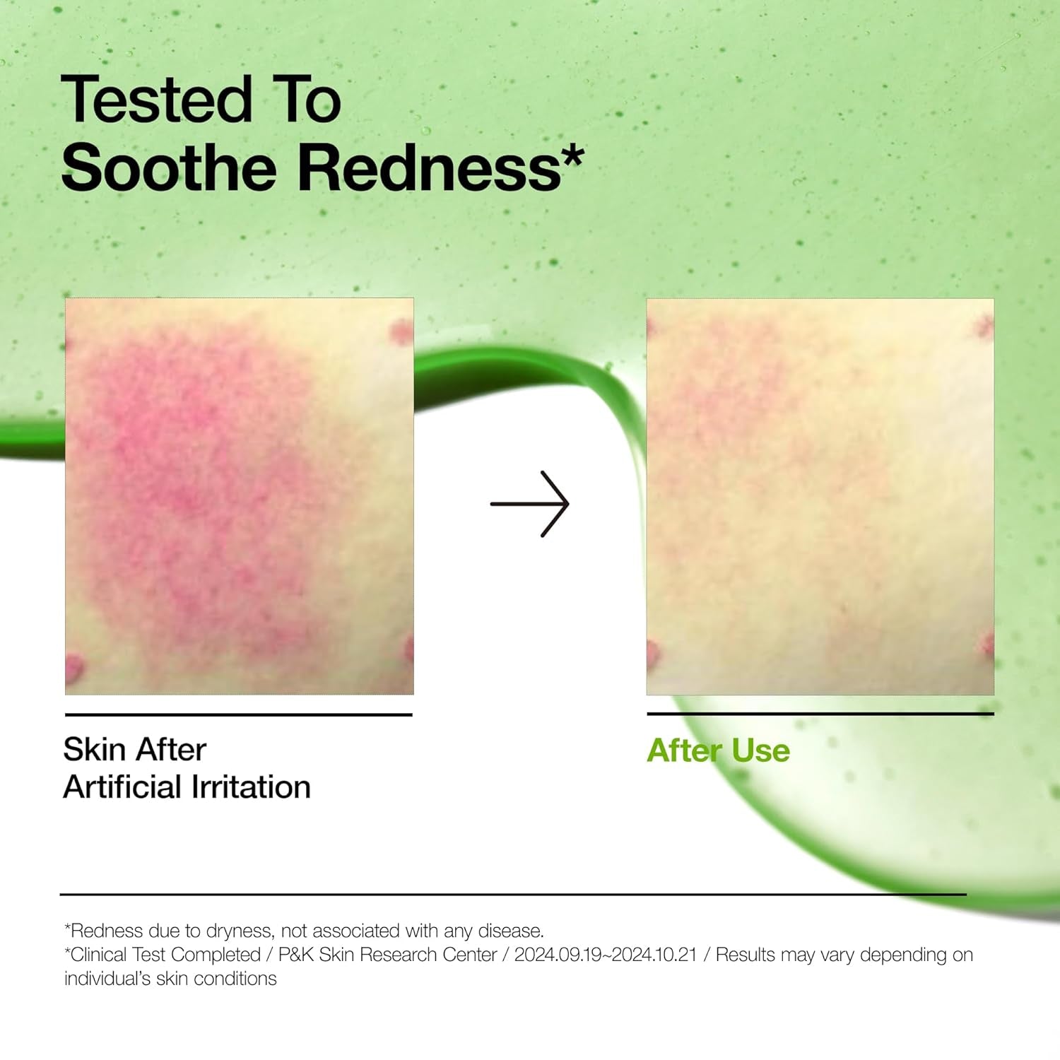 Anua Azelaic Acid 10% Serum (30ml)